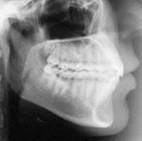Radiologia Odontológica em Candeias